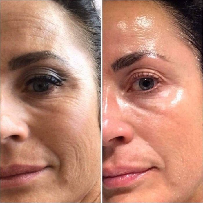 e7a419ace7f7ee605d5bf36ade2b17aa